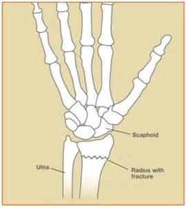 bone 1
