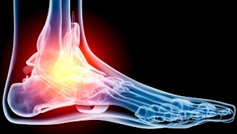 Grand Rapids MI Orthopedic Doctors