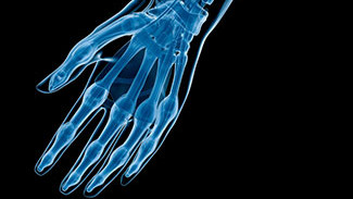 Orthopedic Surgeons in Greater Grand Rapids, MI